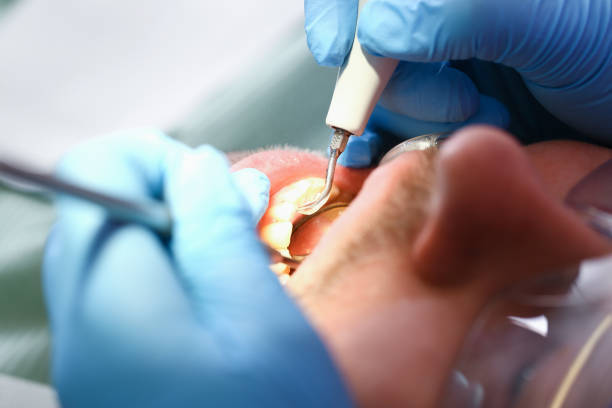 Best Emergency Broken Tooth Repair in Carrollwood, FL