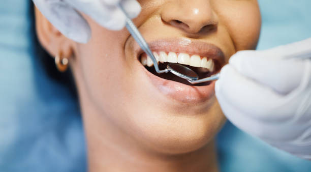 Best Same-Day Emergency Dentist in Carrollwood, FL